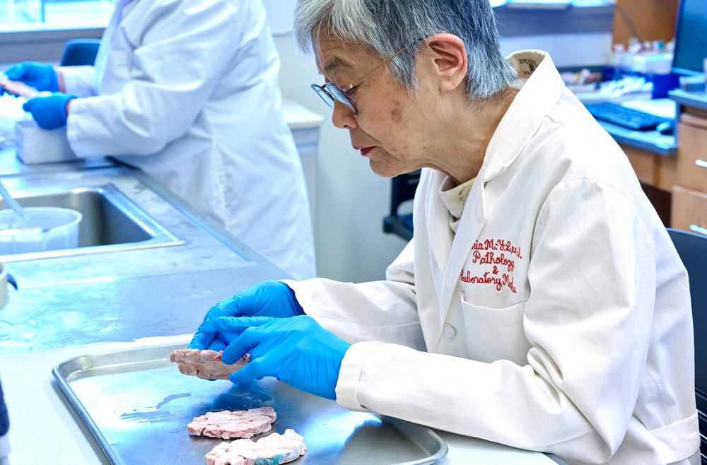 Virginia M.-Y. Lee, PhD, examines a brain specimen as part of her research with the Penn Medicine brain bank.